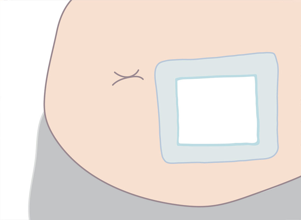 plaster_silikon_06.jpg